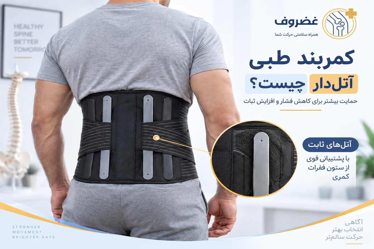 ساختار کمربند طبی آتل‌دار و نمایش آتل‌های پشتیبان کمر